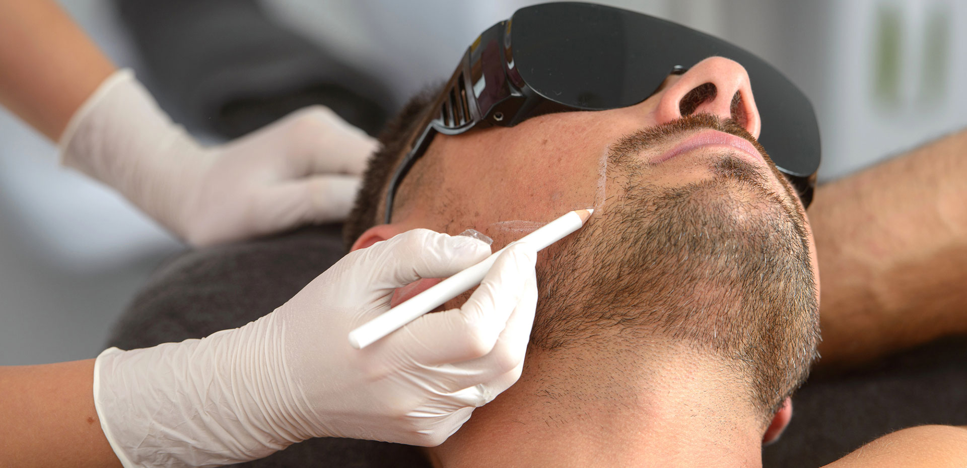 Épilation laser pour homme à Montpellier