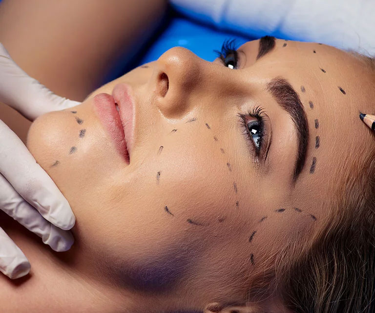 Lifting du visage deep plane Montpellier