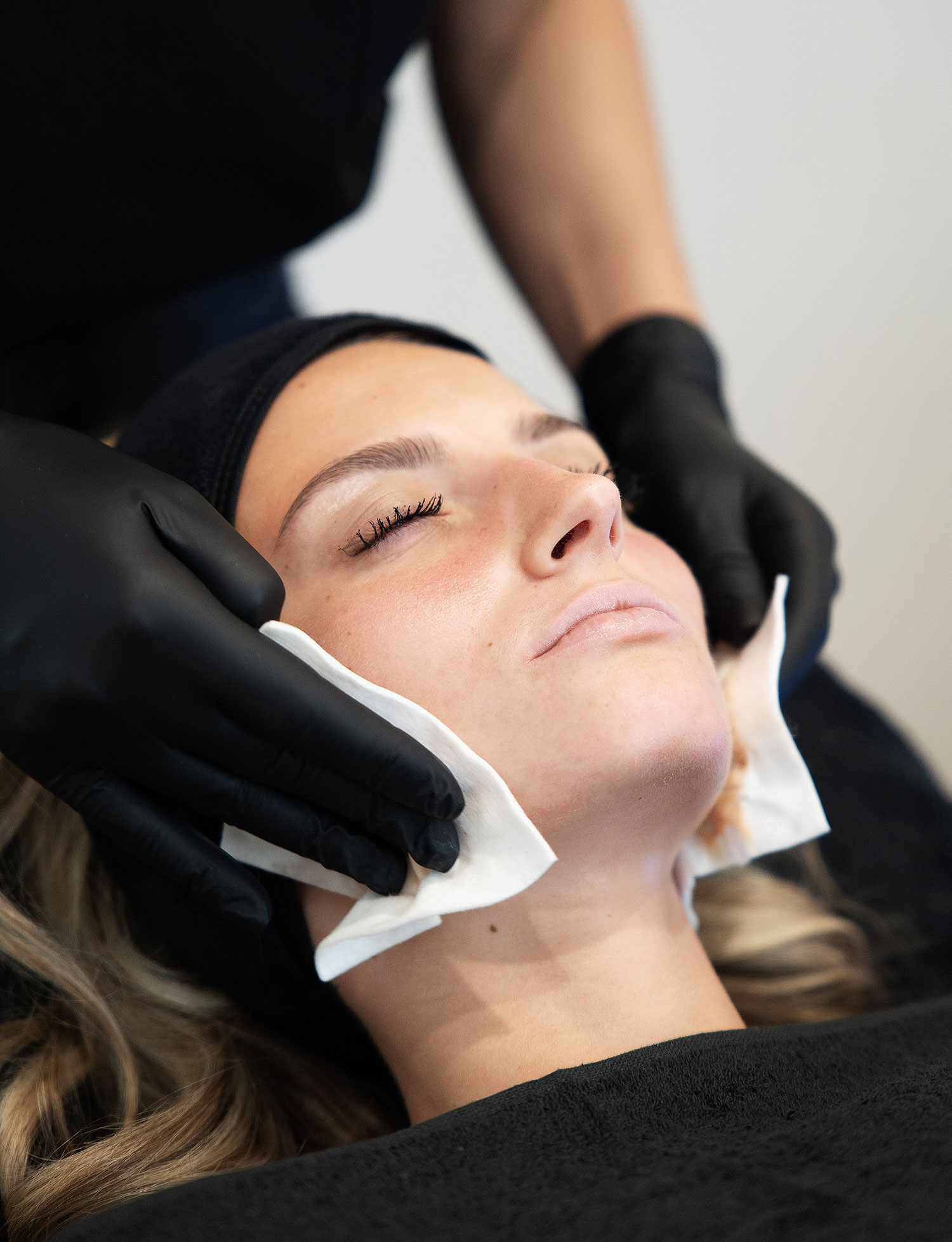 Séance Sofwave au SkinLab
