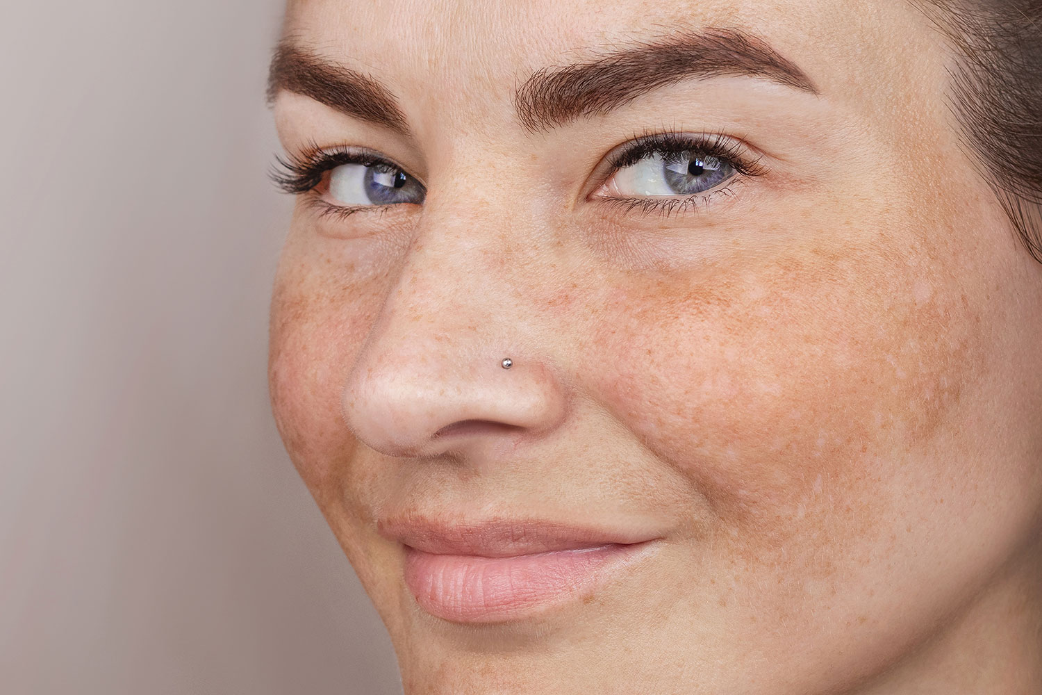 Traitement des taches pigmentaires au visage