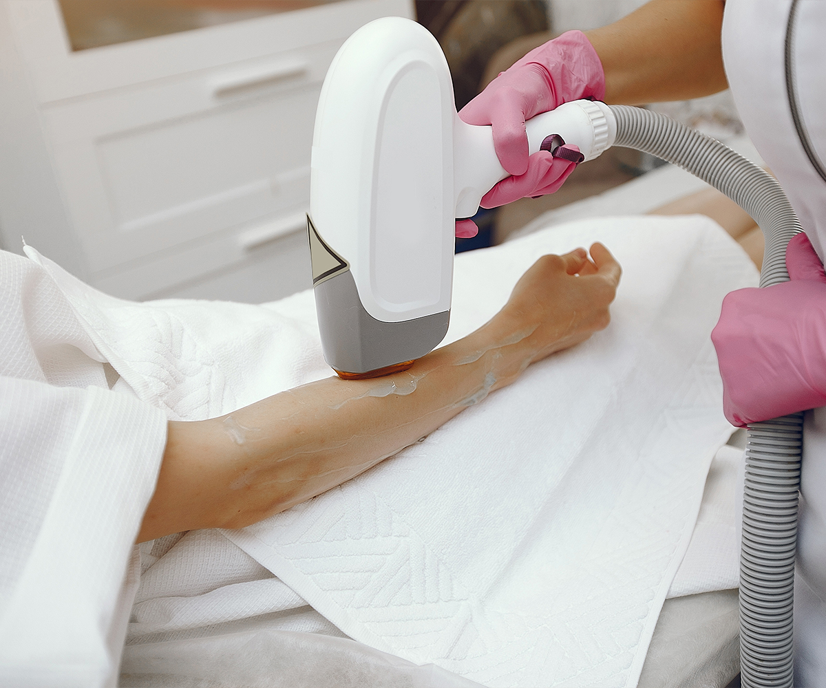 epilation laser a montpellier